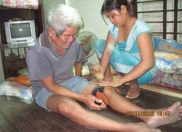 Hoi Phuc Nhanh Sau Tai Bien Lan Thu 2